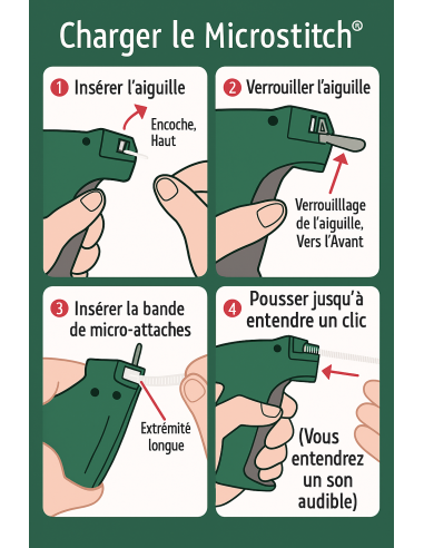 Kit pistolet à bâtir avec agrafes MicroStitch